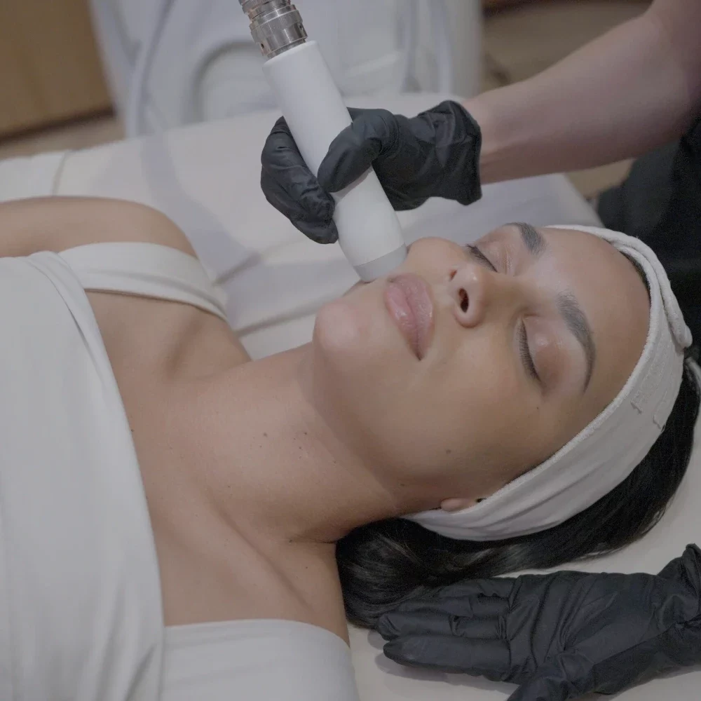 T-Shape 2 facial treatment on the cheek at iCRYO Clifton Park